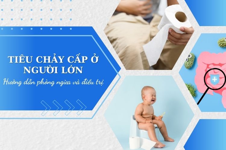 Hướng dẫn phòng ngừa và điều trị tiêu chảy cấp ở người lớn